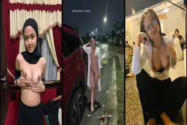 video full komplikasi Kayla viral